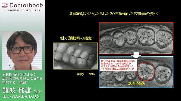 歯科　ファンクショナルオクルージョン BK02608.jpg